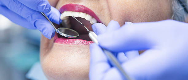 Best Urgent Care for Lost Fillings or Crowns in Nederland, CO